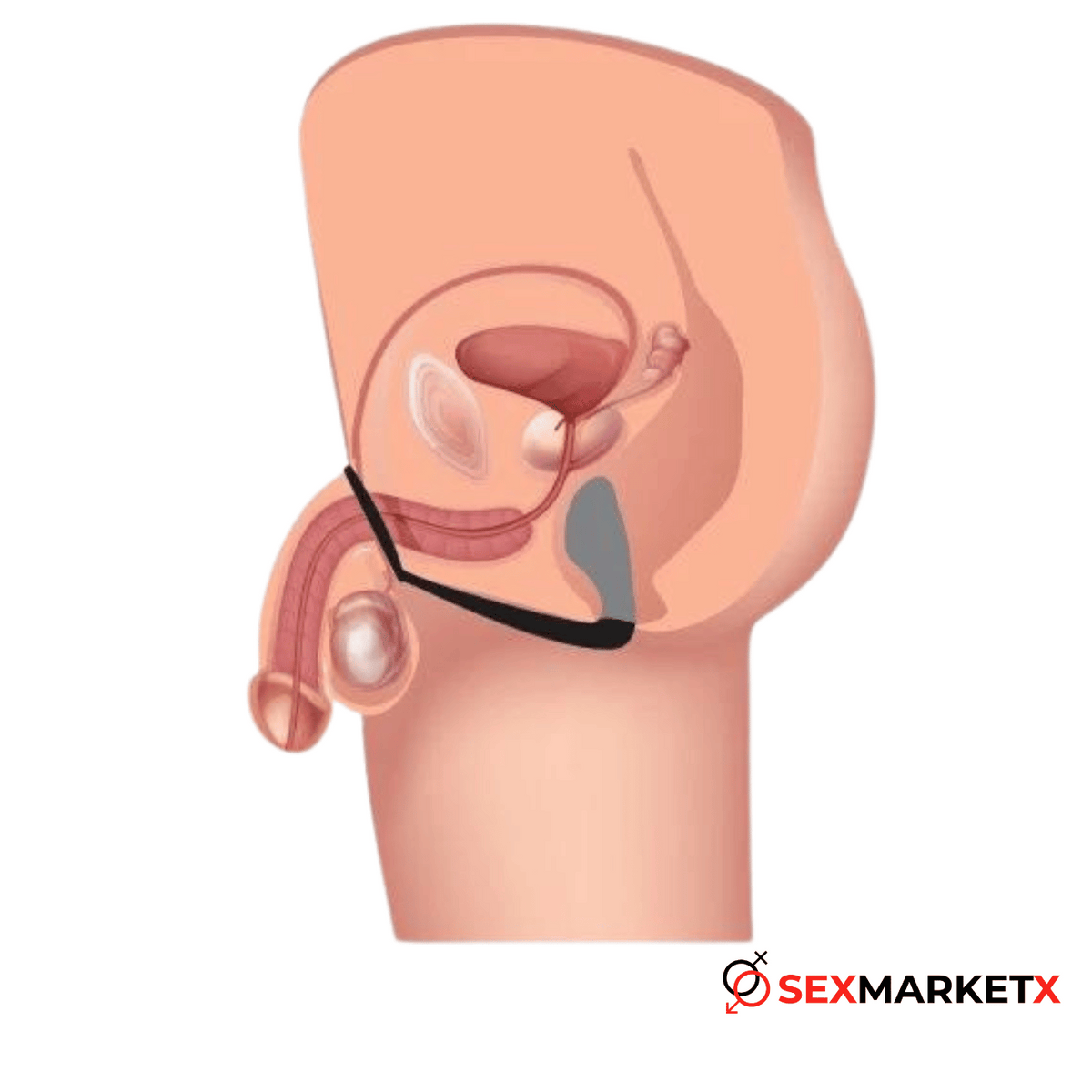 Anillo estimulador de prostata - anales - envio discreto a Colombia - producto de bienestar íntimo
